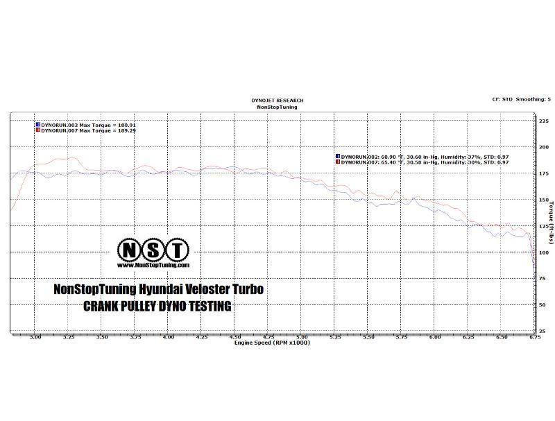 Water Pump Pulley Lightweight NST31625 - NonStopTuning 2012-15 Hyundai Veloster