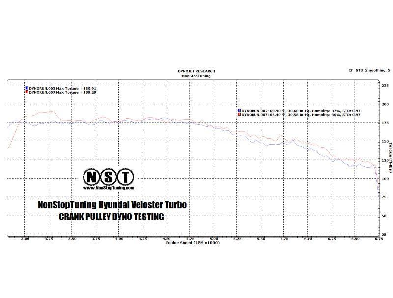 Crank Lightweight & Water Pump Pulley Kit 2 Piece NST31600K - NonStopTuning 2012-15 Hyundai Veloster